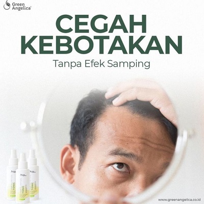 Obat Penumbuh Rambut Cepat - Green Angelica Hair